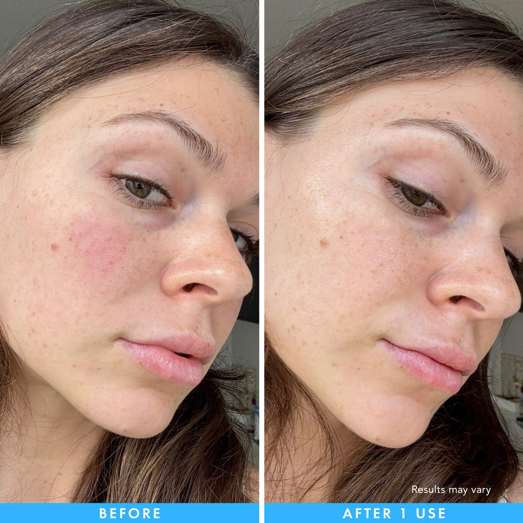 Cryo + Soothing Hydrogel Mask A8