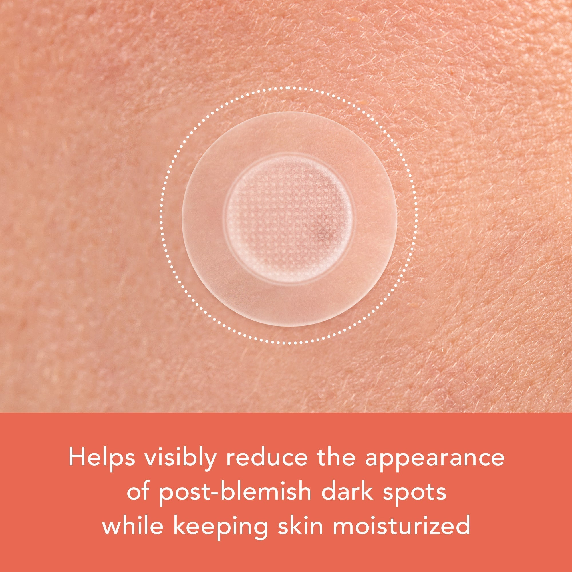 Miracle Patch Microcrystal Vitamin C Dark Spot Cover L7