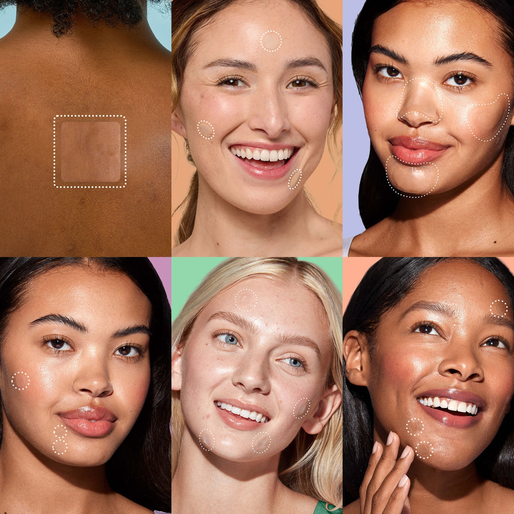 Miracle Patch Ultimate Blemish Patch Kit G5