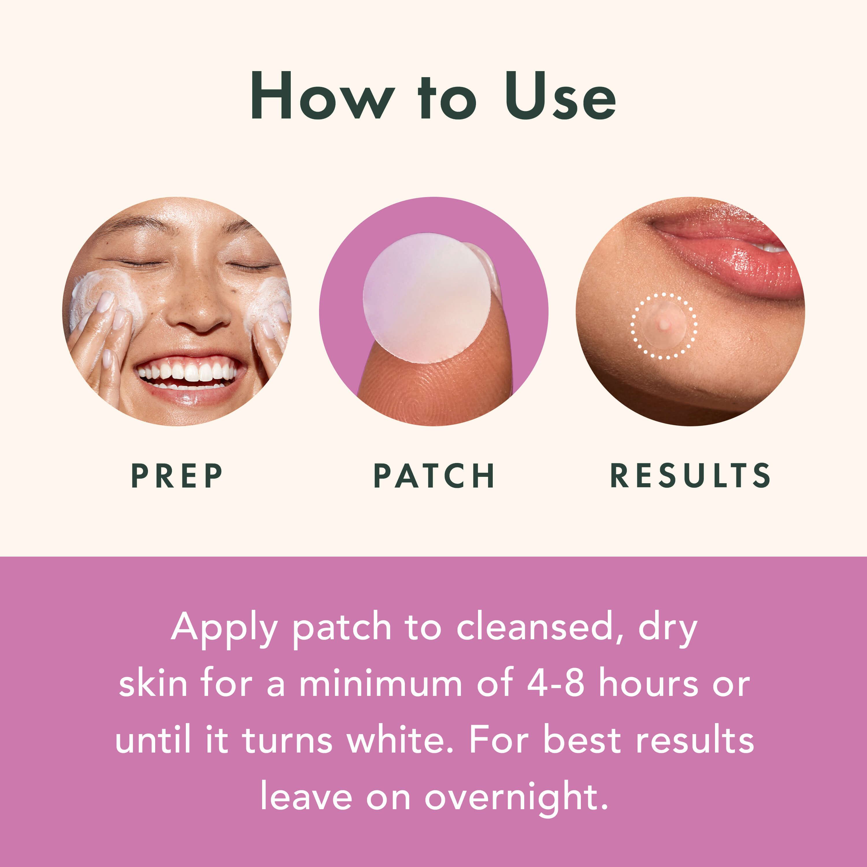Miracle Patch Overnight Spot Cover B7